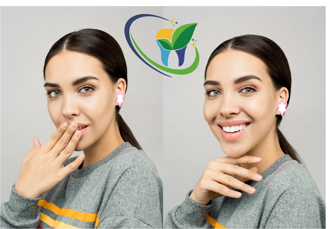 SMILE MAKEOVER - For the ‌‌‌‌‌‌‌‌‌ ‌‌Ü in You