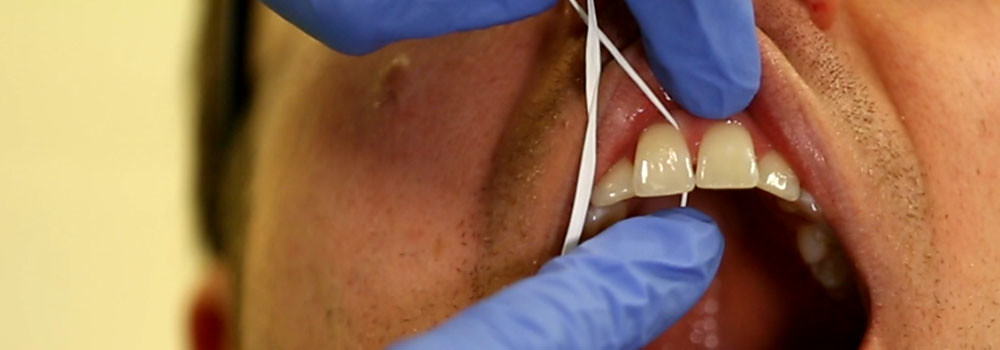 Flossing